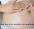 cremas antiestrias embarazo